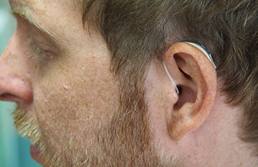 Kulak içi işitme cihazı fiyatları 2023
